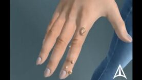 What are warts (HPV).