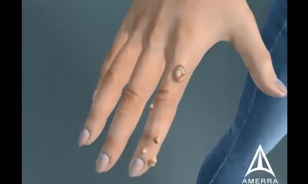 What are warts (HPV).