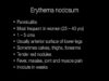 What is Erythema Nodosum.