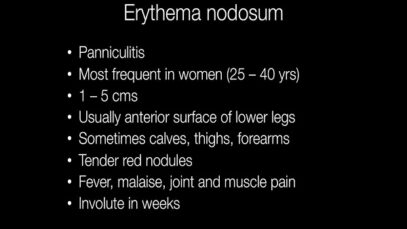 What is Erythema Nodosum.