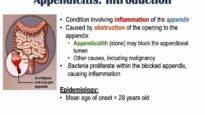 Appendicitis Signs Symptoms _ Why They Occur