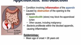 Appendicitis Signs Symptoms _ Why They Occur