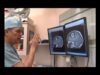 Brain Surgery