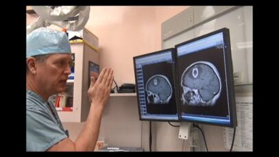 Brain Surgery