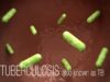 CDC Tuberculosis (TB) Transmission and Pathogenesis