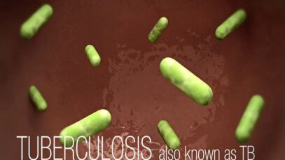 CDC Tuberculosis (TB) Transmission and Pathogenesis