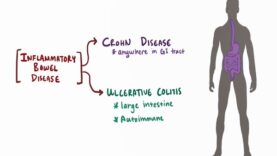Crohn’s disease (Crohn disease) – causes, symptoms pathology