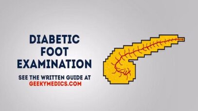 Diabetic foot examination – OSCE guide (old version 2)