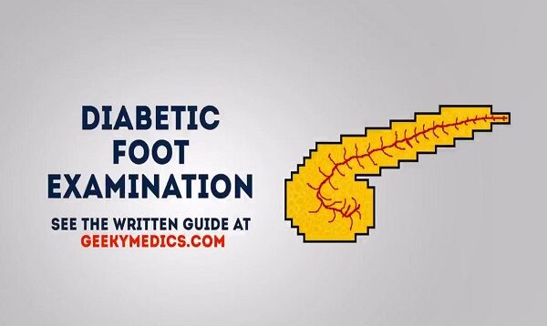 Diabetic foot examination – OSCE guide (old version 2)