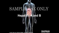 Hepatitis A and B