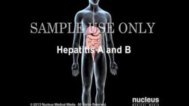 Hepatitis A and B