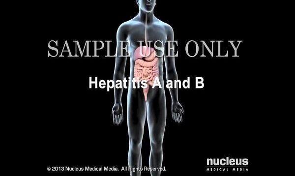 Hepatitis A and B