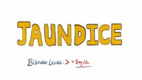 JAUNDICE Differential diagnosis of Jaundice – Prehepatic_Hepatic_Post Hepatic Causes of Jaundice