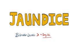 JAUNDICE Differential diagnosis of Jaundice – Prehepatic_Hepatic_Post Hepatic Causes of Jaundice