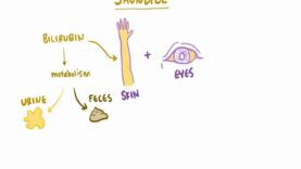 Jaundice, causes treatment pathology