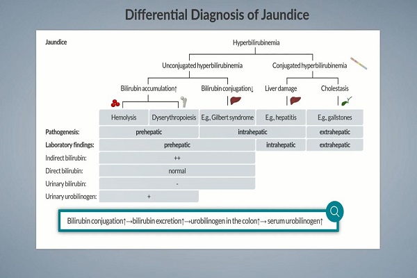 Jaundice_ Differential Diagnosis