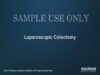 Laparoscopic Colectomy