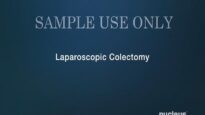 Laparoscopic Colectomy