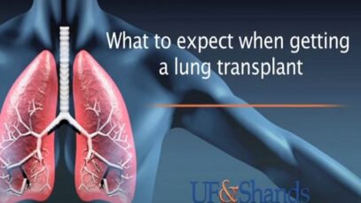 Lung Transplant Patient Journey