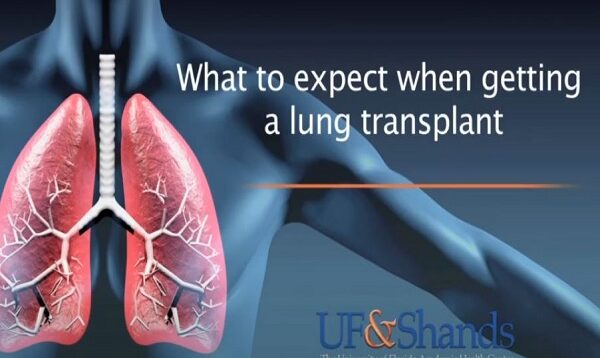 Lung Transplant Patient Journey