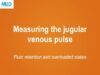 Measuring the jugular venous pulse