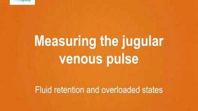 Measuring the jugular venous pulse