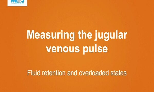 Measuring the jugular venous pulse