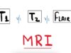 T1 MRI vs T2 MRI vs FLAIR MRI MRI Brain Radiology