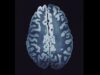 Tesla MRI The Highest Resolution Image of the Brain