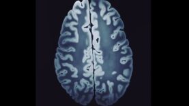 Tesla MRI The Highest Resolution Image of the Brain