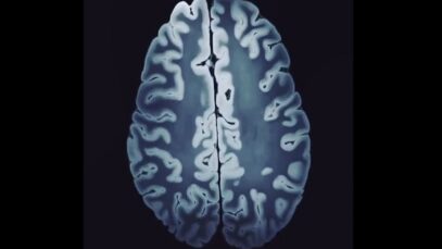 Tesla MRI The Highest Resolution Image of the Brain