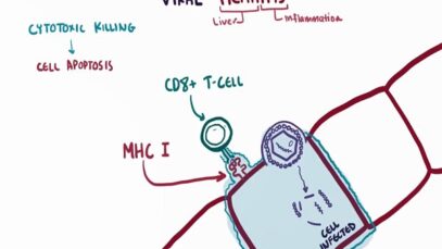Viral hepatitis A B C D E causes symptoms diagnosis