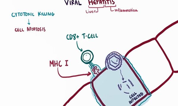 Viral hepatitis A B C D E causes symptoms diagnosis