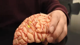 Anatomy of the Brain Dissectible Model