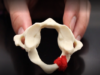 Atlas Axis Cervical Vertebrae (C1-C2) Anatomy