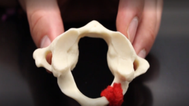 Atlas Axis Cervical Vertebrae (C1-C2) Anatomy