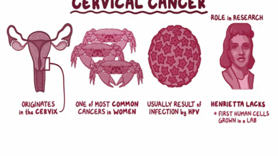 Cervical Cancer