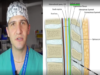 Epidural, spinal, and combined spinal-epidural overview