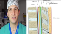 Epidural, spinal, and combined spinal-epidural overview