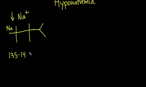 Low Sodium and How to Prevent Osmotic Demyelination Syndrome