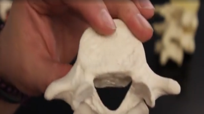 Lumbar Vertebrae (L1-L5) Anatomy