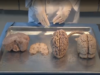 Neuroanatomy Lab