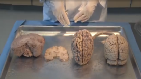 Neuroanatomy Lab
