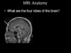 Normal Brain MRI Anatomy