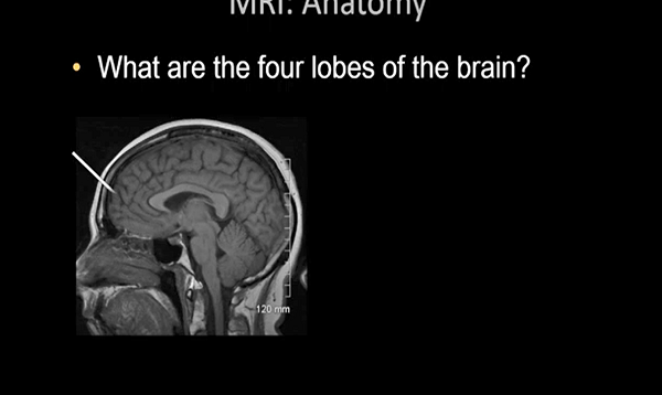 Normal Brain MRI Anatomy