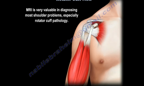 Rotator Cuff MRI Everything You Need To Know