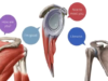 Shoulder joint Movements, bones and muscles