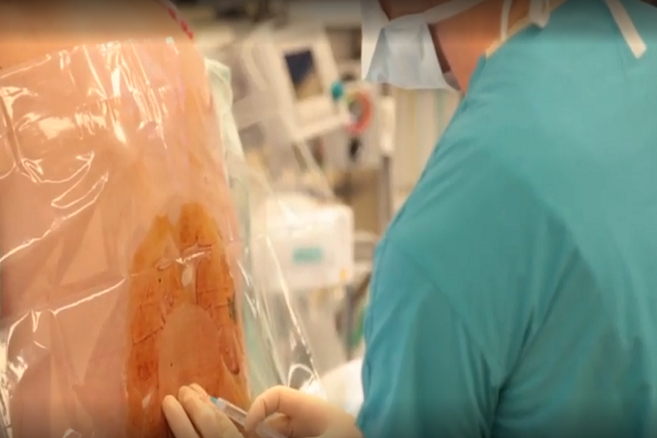 Spinal Block For C-Section