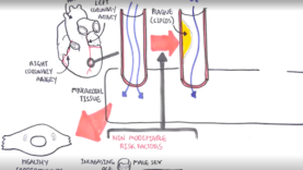 Acute Coronary Syndrome DETAILED Overview