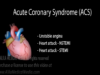 Acute Coronary Syndrome Unstable Angina